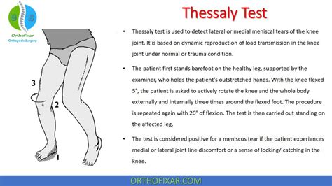 test to demonstrate menicus tear|standing test for meniscus tear.